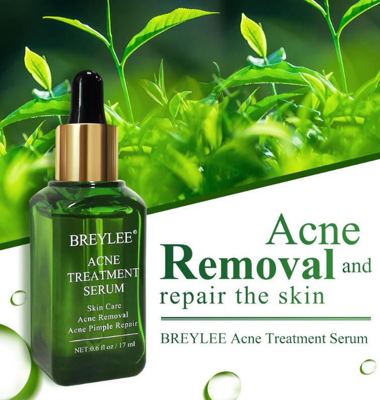 Acne Treatment Serum Facial Repair Oil - AXON