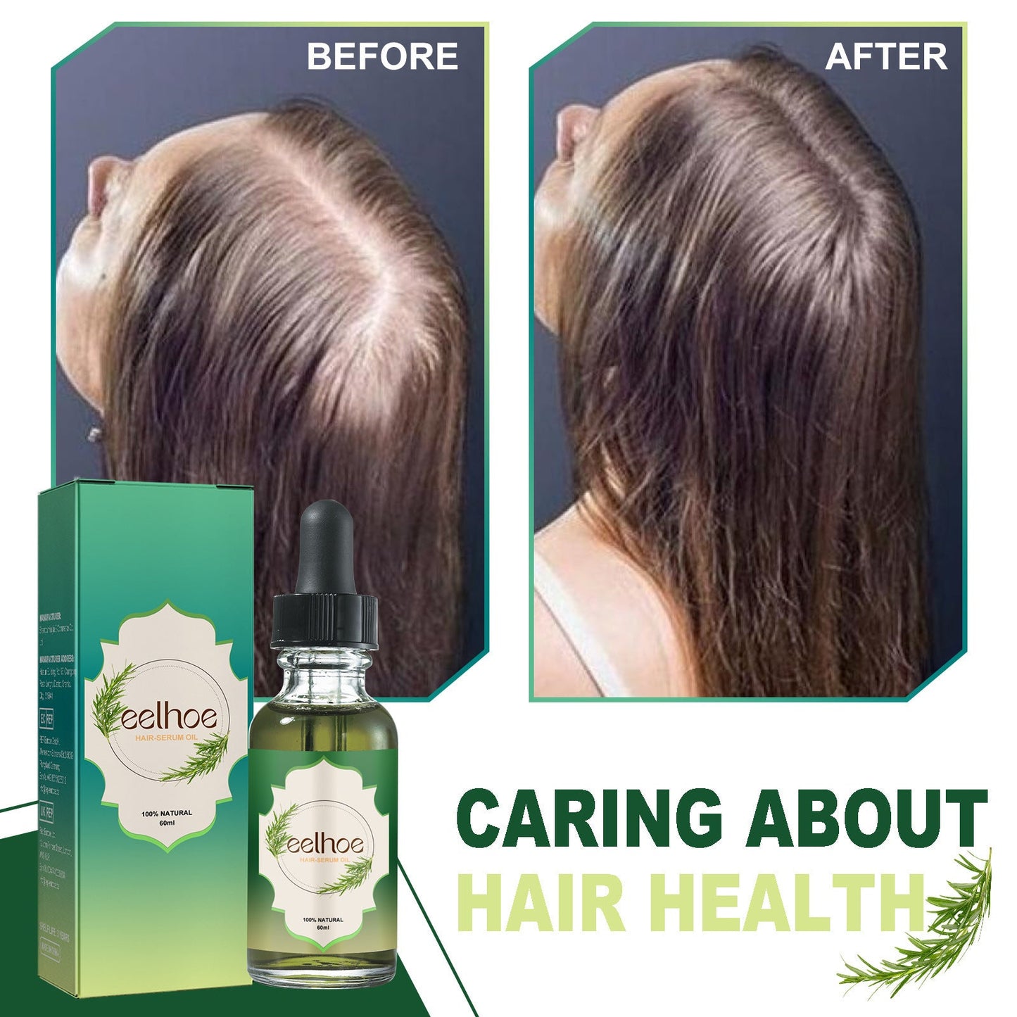 Nourishing Anti - hair Loss Thick Hair Care - AXON