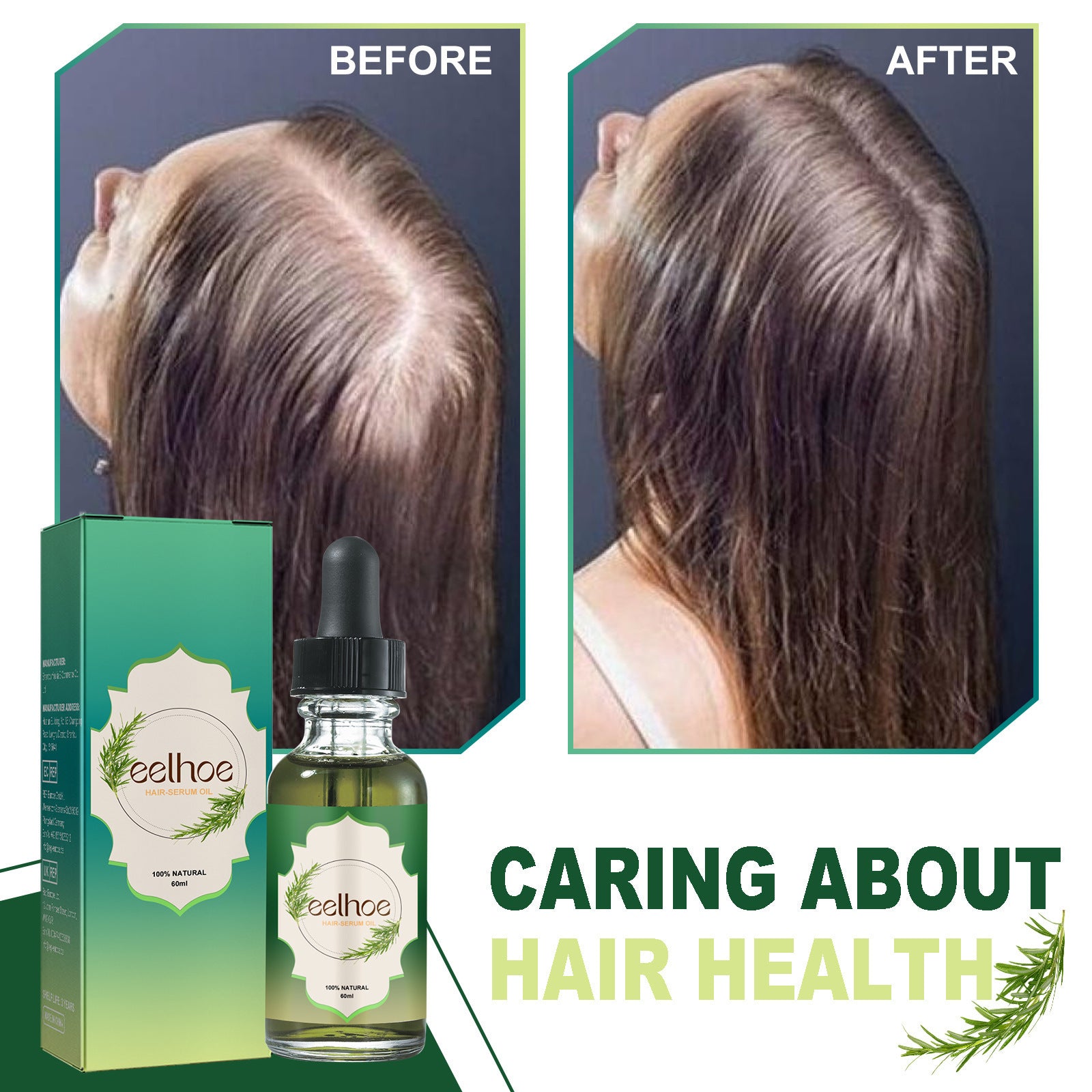 Nourishing Anti - hair Loss Thick Hair Care - AXON